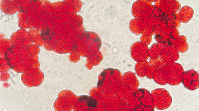 Blood in Urine