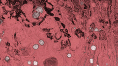 Vaginal pH