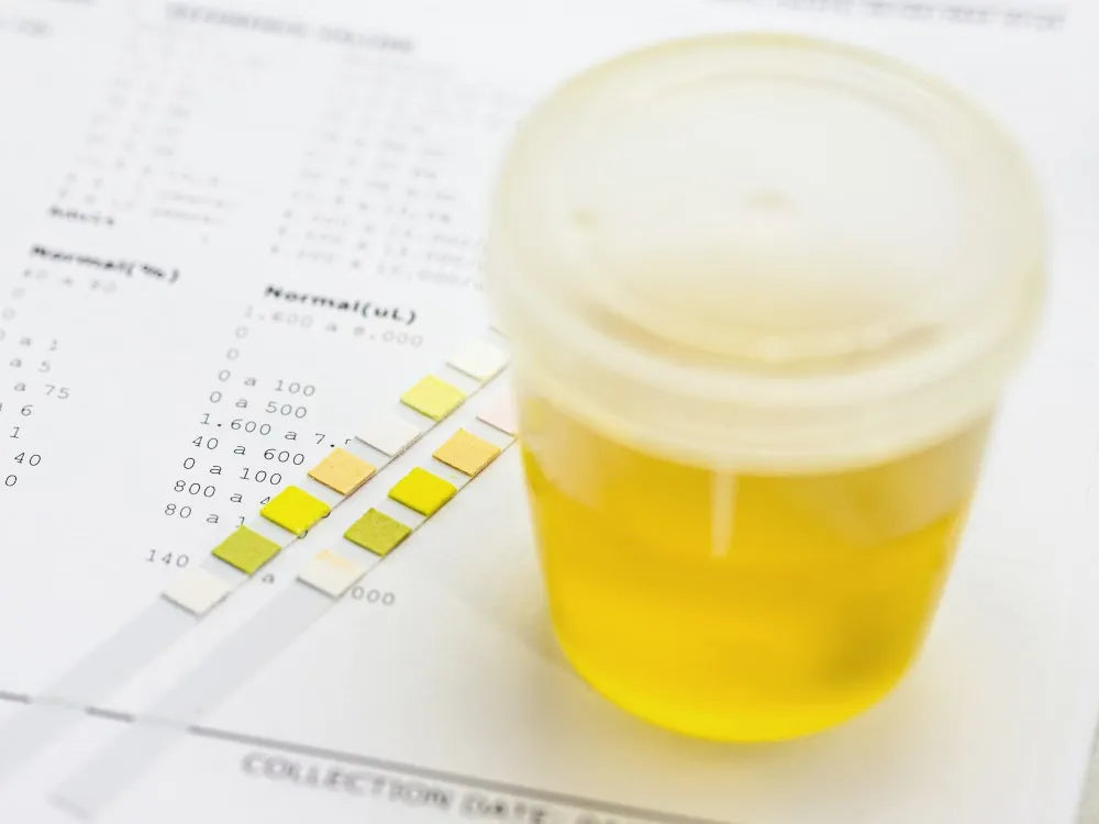 24-Hour Urine Protein Test