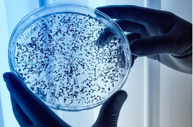 What Does Yeast in Urine Mean?