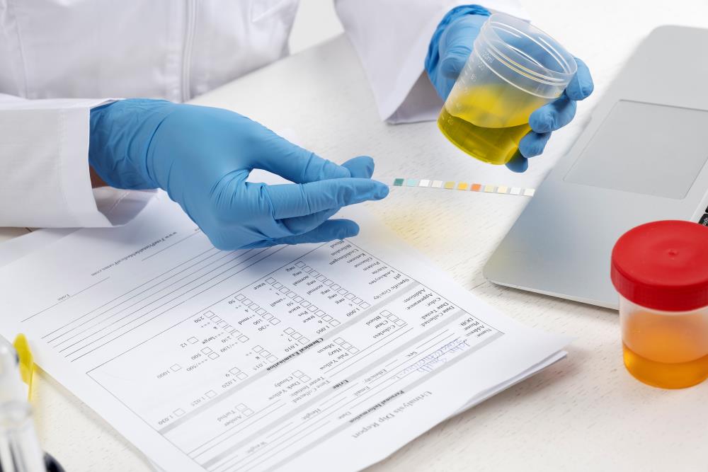 Microalbumin in urine