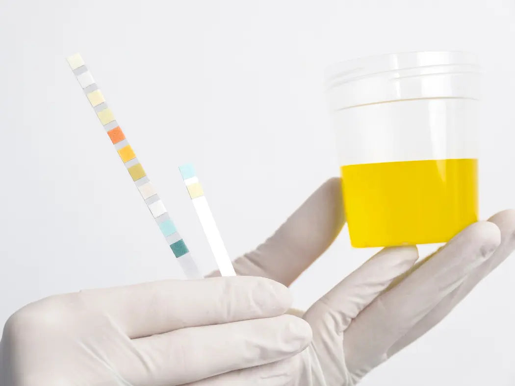 What Is Bacteriuria? Symptoms, Causes, and Treatments