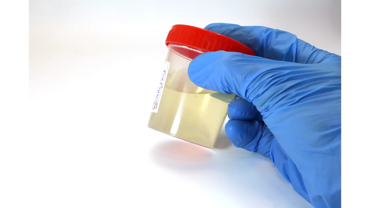 Is High pH in Urine Dangerous?