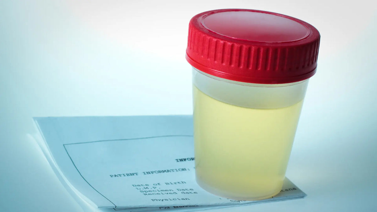 Cloudy Urine? Here’s What It Means and When To Worry