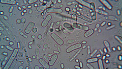 Nitrite in Urine