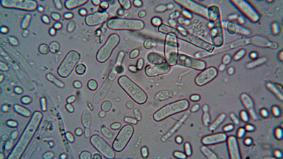 Nitrite in Urine