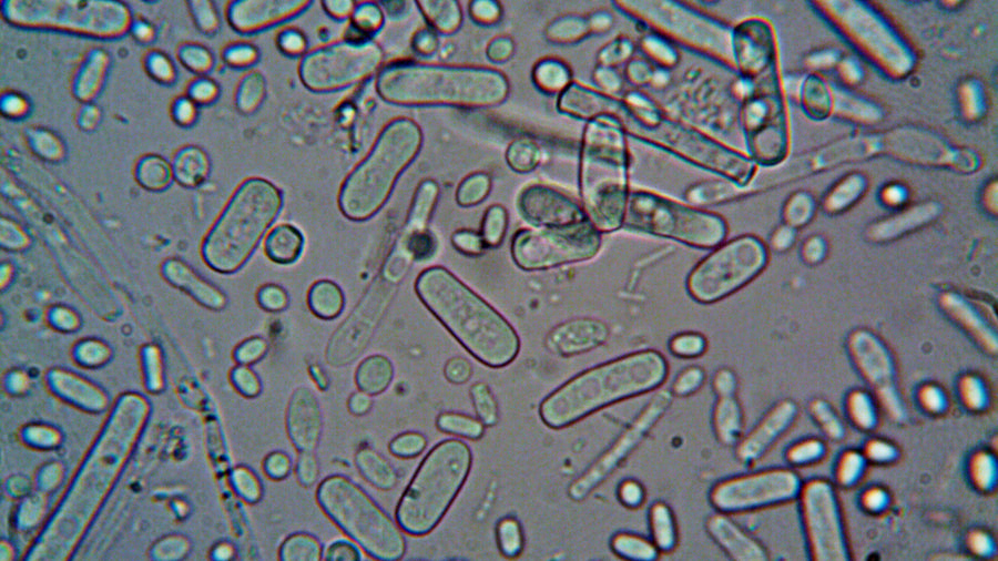 Nitrite in Urine