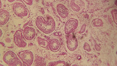 Urobilinogen in Urine