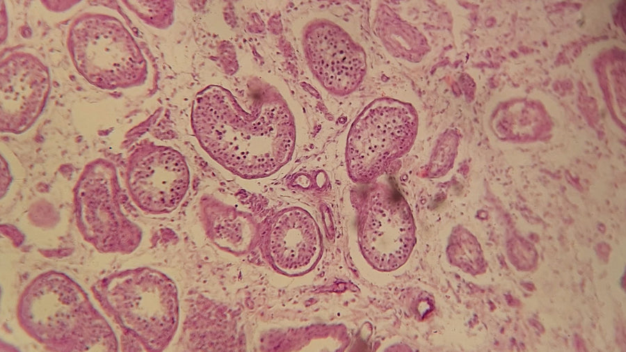 Urobilinogen in Urine