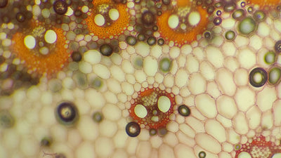 Protein in Urine