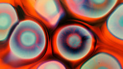 Glucose in Urine