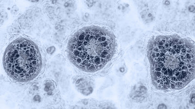 Hydrogen Sulfide in Water