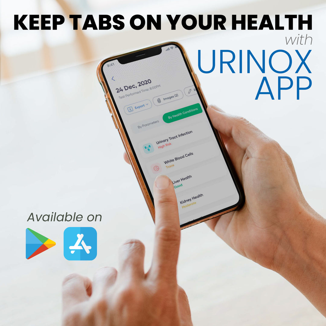 Urinox10 Urinalysis Test Strips 20 Tests/Bx Diagnox Health